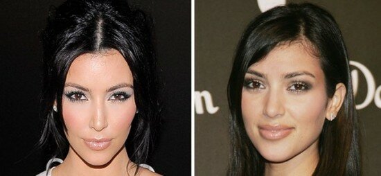 Has Kim Kardashian had plastic surgery?