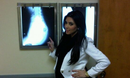 Kim Kardashian booty xray